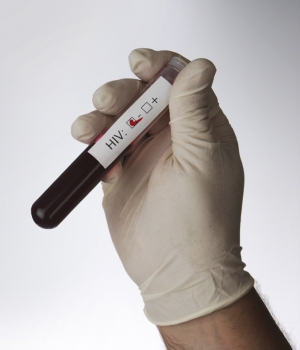 éprouvette contenant du sang testé HIV